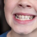 child-s-crooked-teeth-young-man-showing-crooked-g-2023-11-27-05-19-20-utc