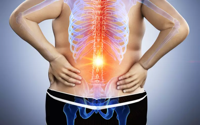 Foto 2 - O excesso de peso sobrecarrega a coluna e pode causar dores e inflamações- créditos- Shutterstock