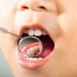 Foto-Odontopediatria