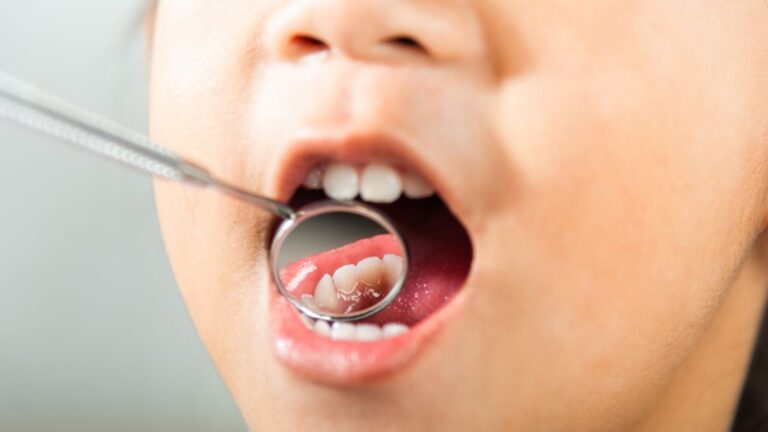 Foto-Odontopediatria